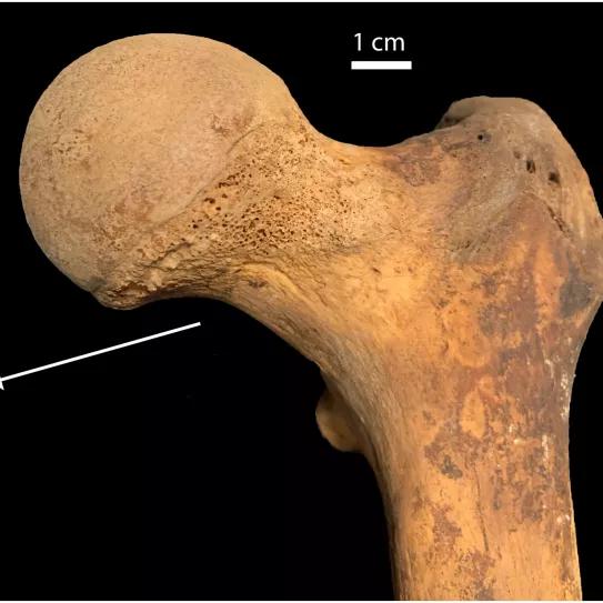 Italia: arqueólogos encuentran rastros de cannabis en huesos humanos del siglo XVII