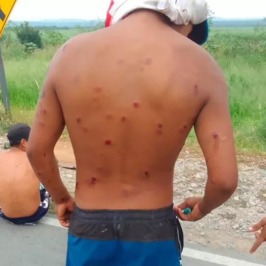 “Milei ya tiene su primer muerto” después de una brutal represión contra personas que transportan hojas de coca