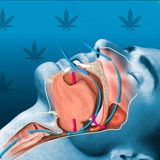 Cannabis mejora el sueño en pacientes con apnea