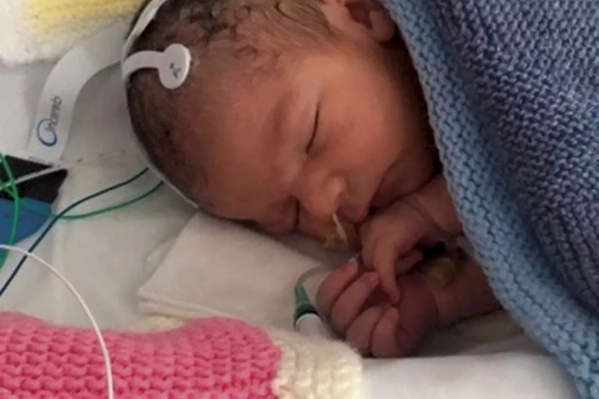 bebé nacido prematuramente en Reino Unido 