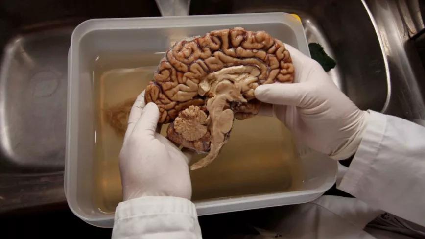 Roba un cerebro embalsamado para usar el líquido con su hierba