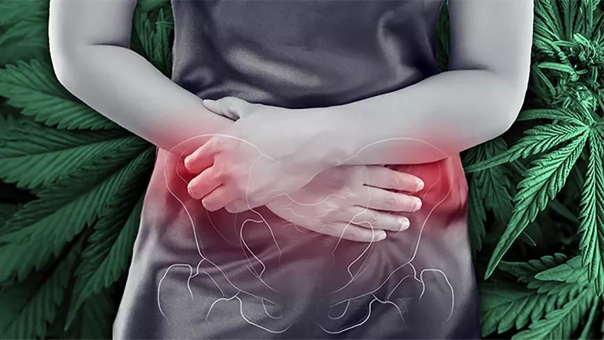 El cannabis también sirve a las pacientes con dolor pélvico crónico