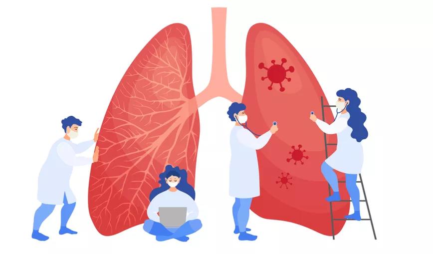 Extractos de cannabis podrían reducir la insuficiencia pulmonar en casos de covid 