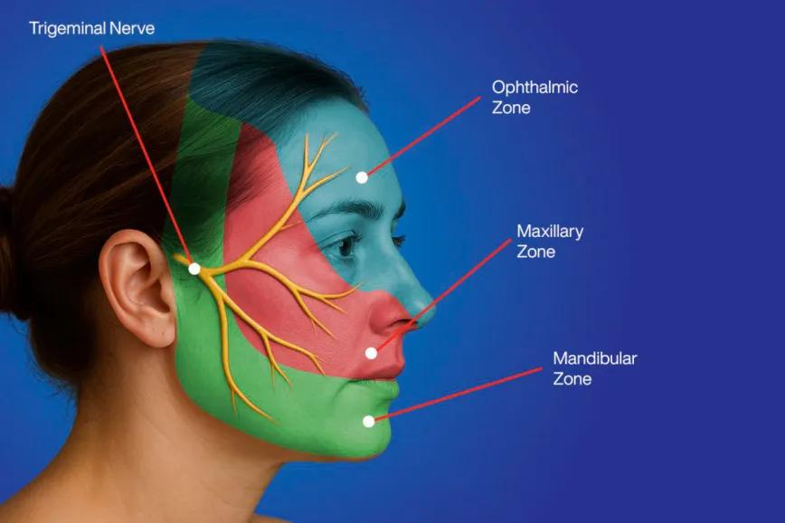 Cannabinoides alivian dolor facial severo en caso clínico en Brasil
