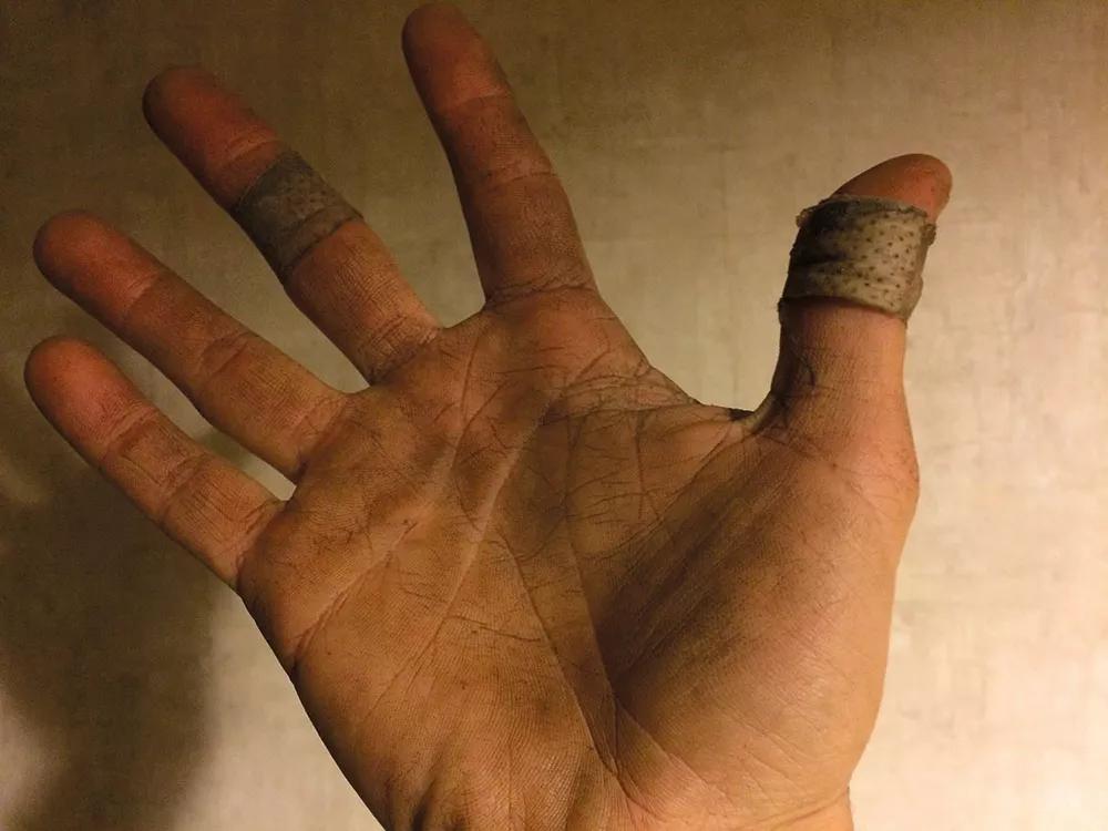 Así estaban las manos de Ezu al cuarto día de trabajo.