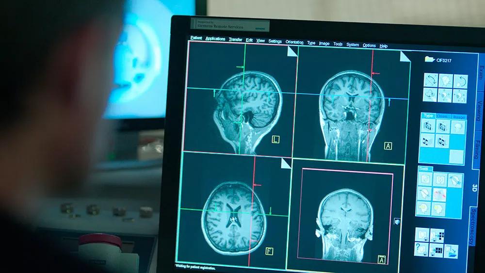 Psicodelia terapéutica para las masas